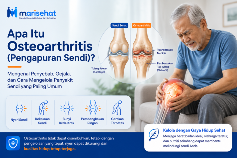 Apa Itu Osteoarthritis