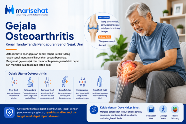 Gejala Osteoarthritis